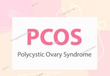 PCOS Infertility: Dos and Don’ts, Foods, Treatment, Misconception, all you need to know about condition